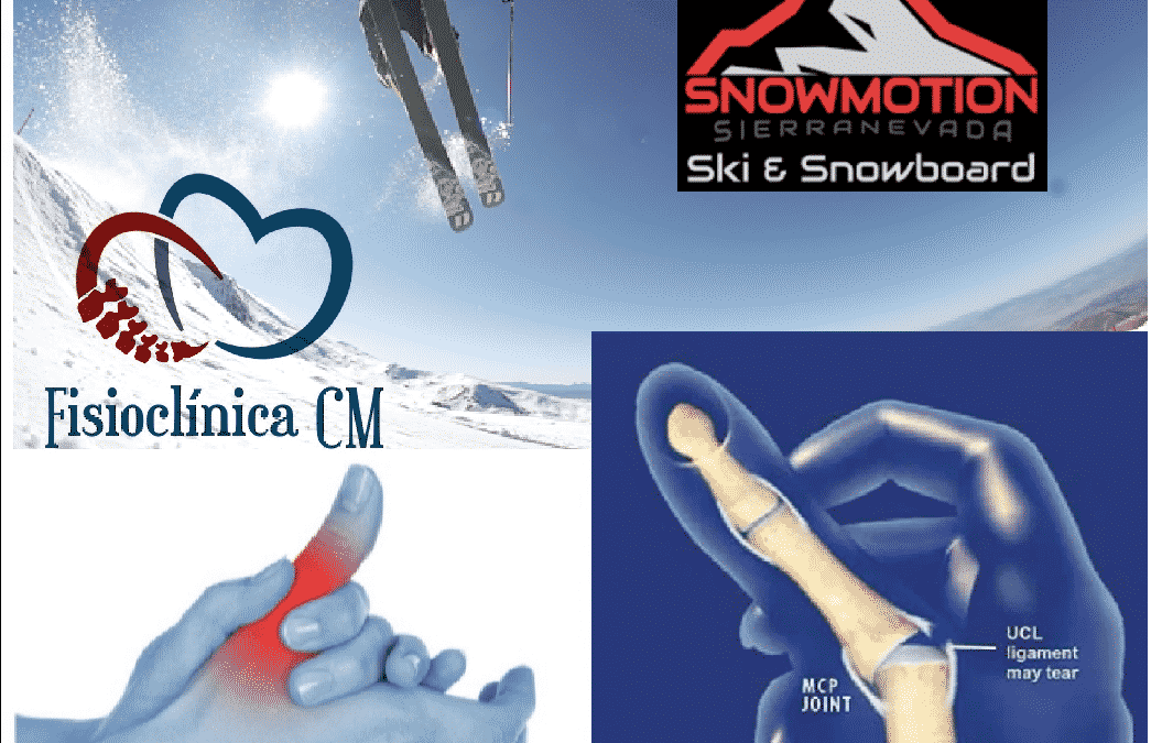Snowboard y Esquí, beneficios y lesiones más frecuentes