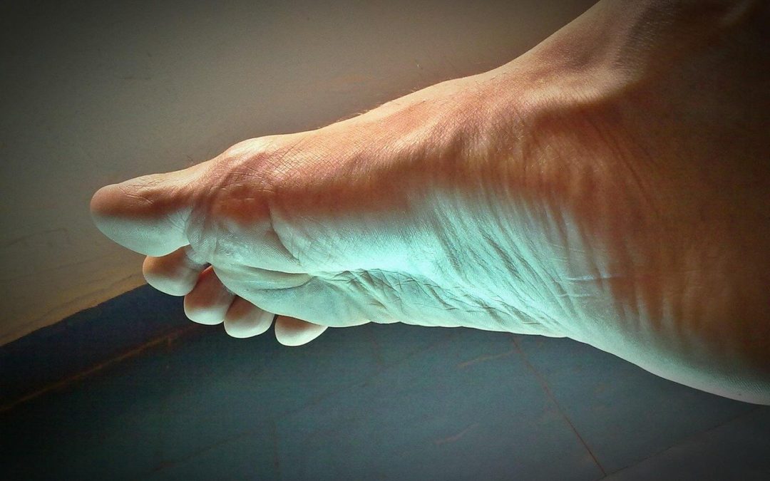 Fascitis plantar con ecografía: caso clínico